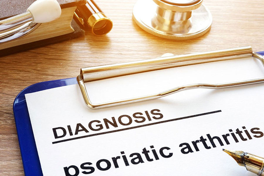 Artritis Semos